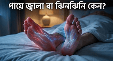 ডায়াবেটিসে পায়ে জ্বালাপোড়া ও ঝিনঝিনি